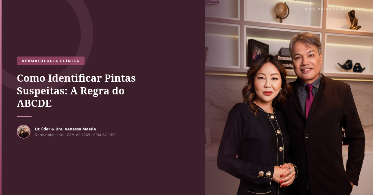 Como Identificar Pintas Suspeitas: A Regra do ABCDE