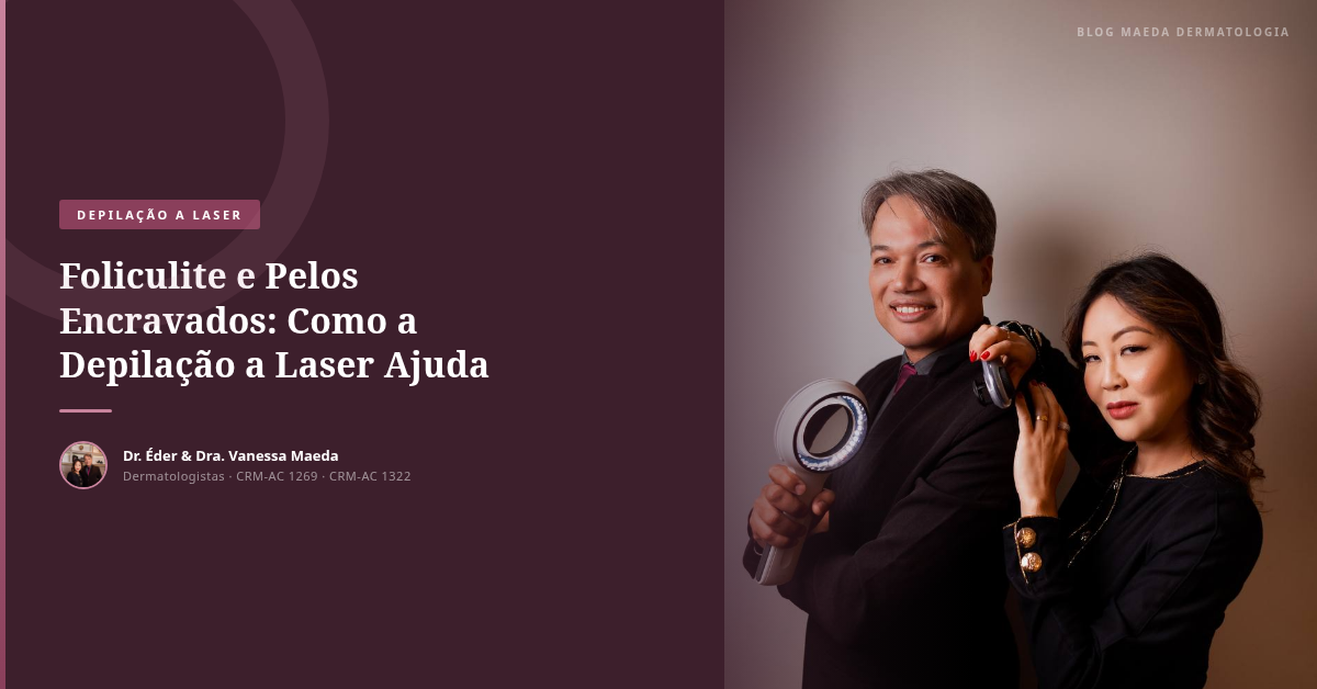 Foliculite e Pelos Encravados: Como a Depilação a Laser Ajuda