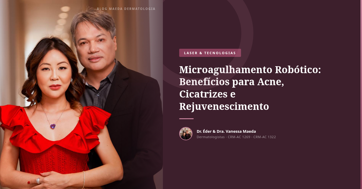Microagulhamento Robótico: Benefícios para Acne, Cicatrizes e Rejuvenescimento