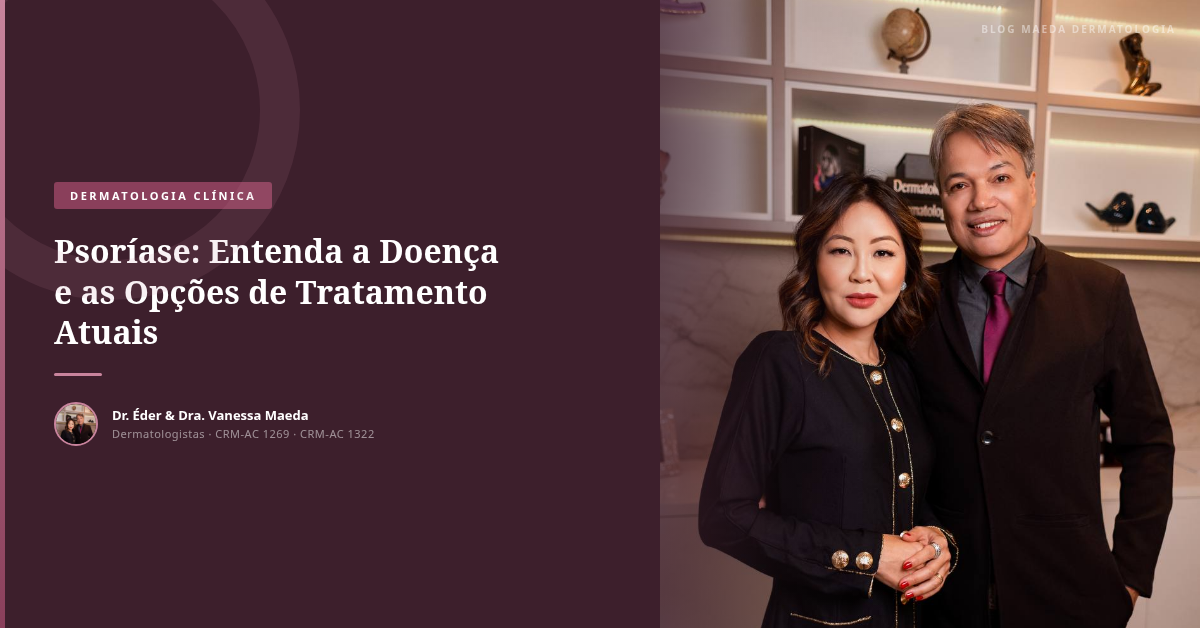 Psoríase: Entenda a Doença e as Opções de Tratamento Atuais