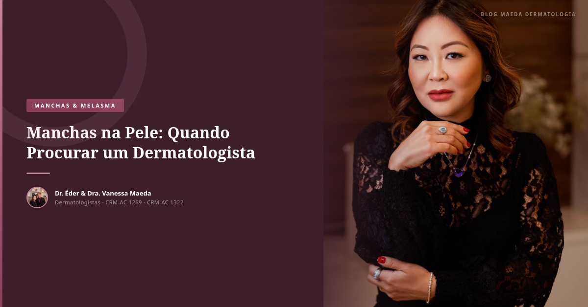 Manchas na Pele: Quando Procurar um Dermatologista