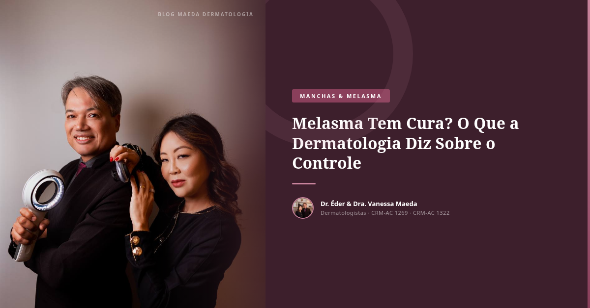 Melasma Tem Cura? O Que a Dermatologia Diz Sobre o Controle