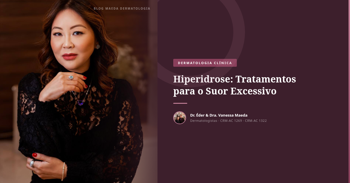 Hiperidrose: Tratamentos para o Suor Excessivo