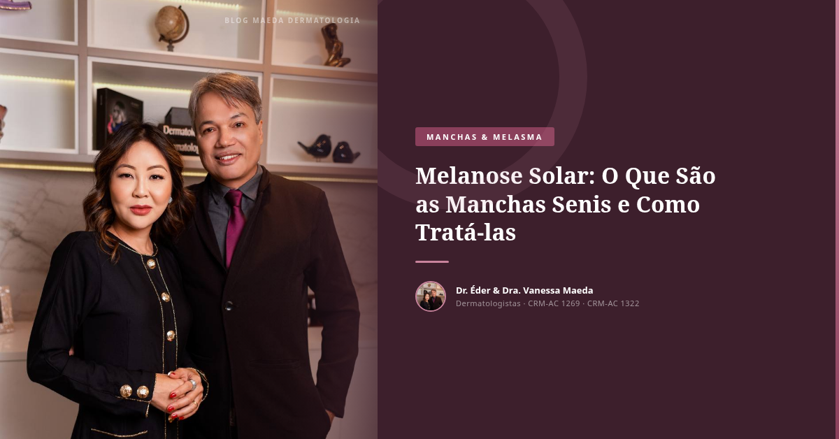Melanose Solar: O Que São as Manchas Senis e Como Tratá-las