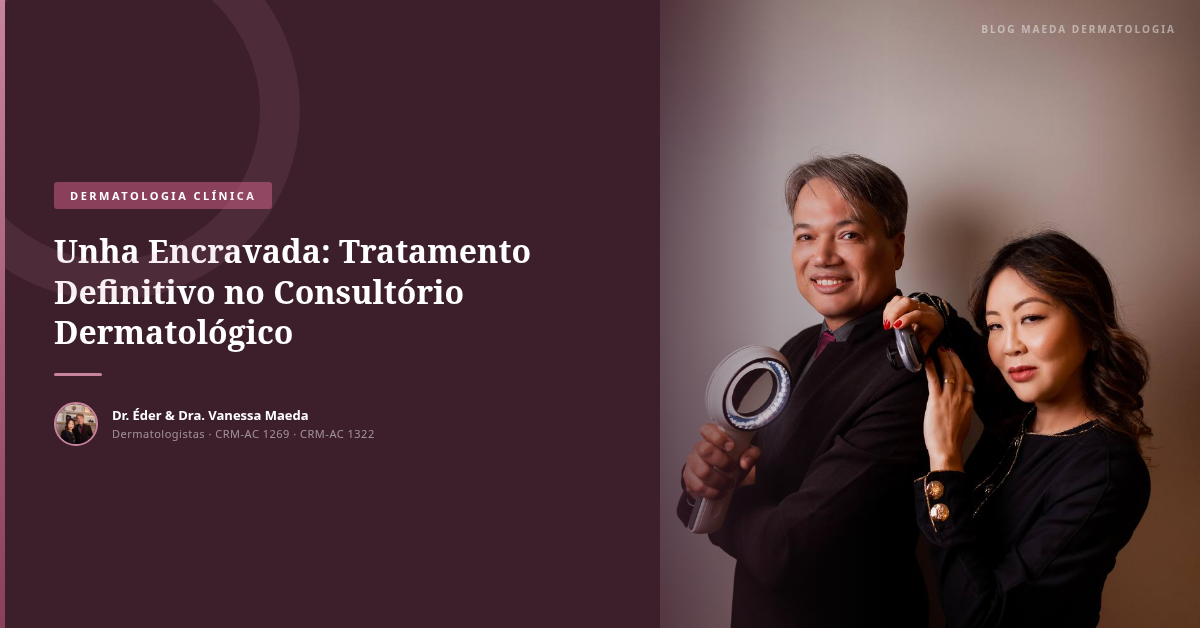 Unha Encravada: Tratamento Definitivo no Consultório Dermatológico