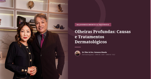 Olheiras Profundas: Causas e Tratamentos Dermatológicos