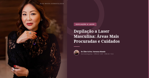 Depilação a Laser Masculina: Áreas Mais Procuradas e Cuidados