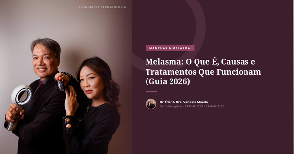 Melasma: O Que É, Causas e Tratamentos Que Funcionam (Guia 2026)