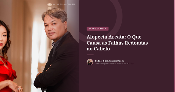 Alopecia Areata: O Que Causa as Falhas Redondas no Cabelo