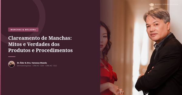Clareamento de Manchas: Mitos e Verdades dos Produtos e Procedimentos