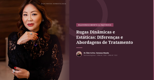Rugas Dinâmicas e Estáticas: Diferenças e Abordagens de Tratamento