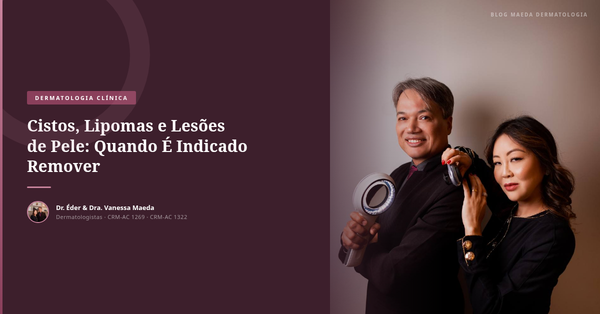 Cistos, Lipomas e Lesões de Pele: Quando É Indicado Remover