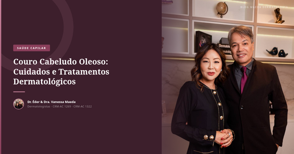 Couro Cabeludo Oleoso: Cuidados e Tratamentos Dermatológicos