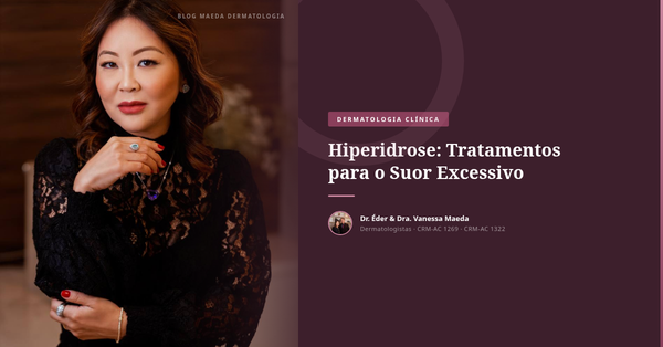 Hiperidrose: Tratamentos para o Suor Excessivo
