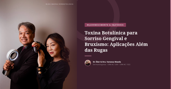 Toxina Botulínica para Sorriso Gengival e Bruxismo: Aplicações Além das Rugas