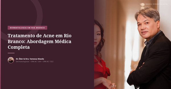 Tratamento de Acne em Rio Branco: Abordagem Médica Completa