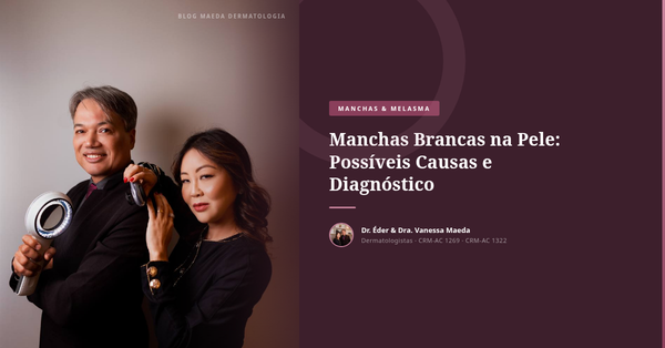 Manchas Brancas na Pele: Possíveis Causas e Diagnóstico