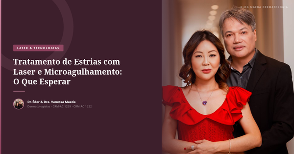 Tratamento de Estrias com Laser e Microagulhamento: O Que Esperar